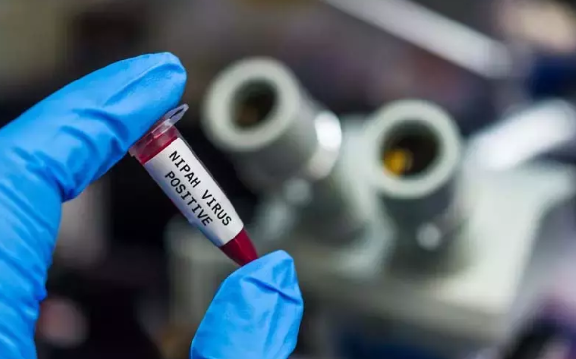 Nipah virüsü nedir? Nasıl bulaşır, belirtileri neler? Türkiye’de var mı?