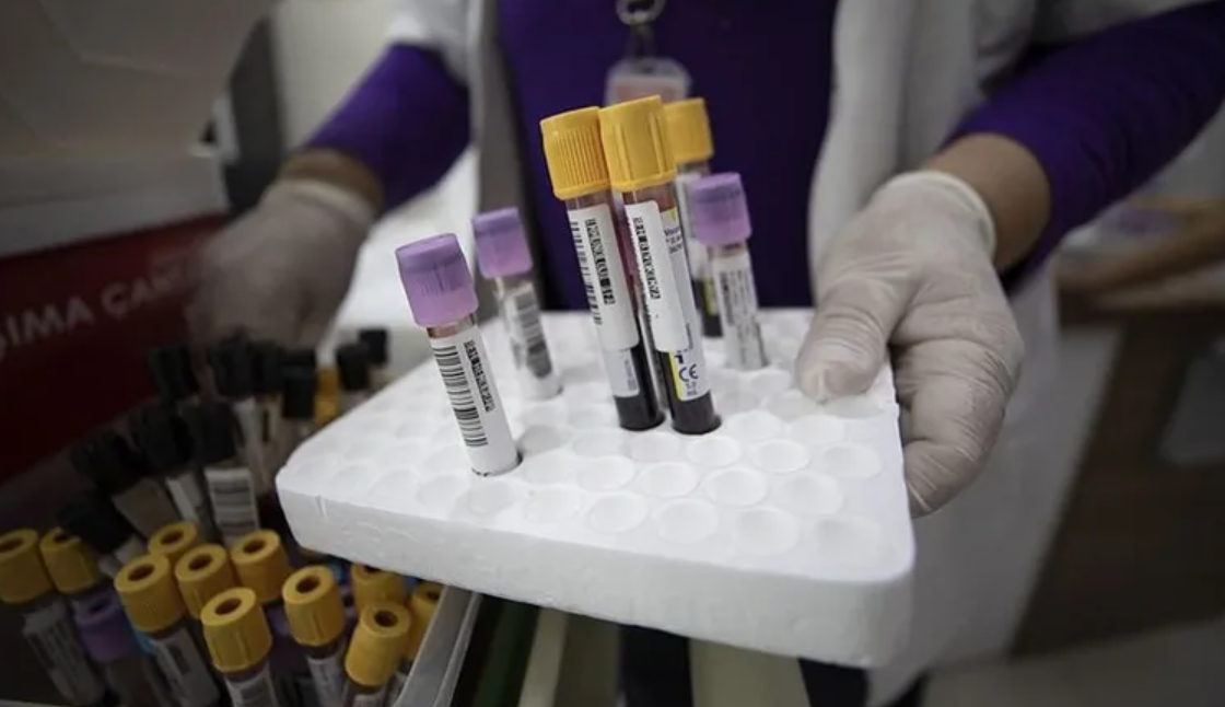 İşe girişte yeni dönem: Madde testi zorunluluğu yayılıyor